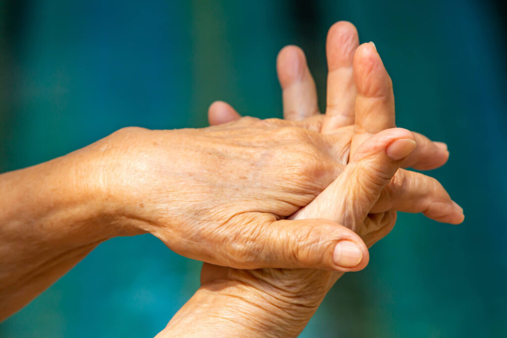 arthritis