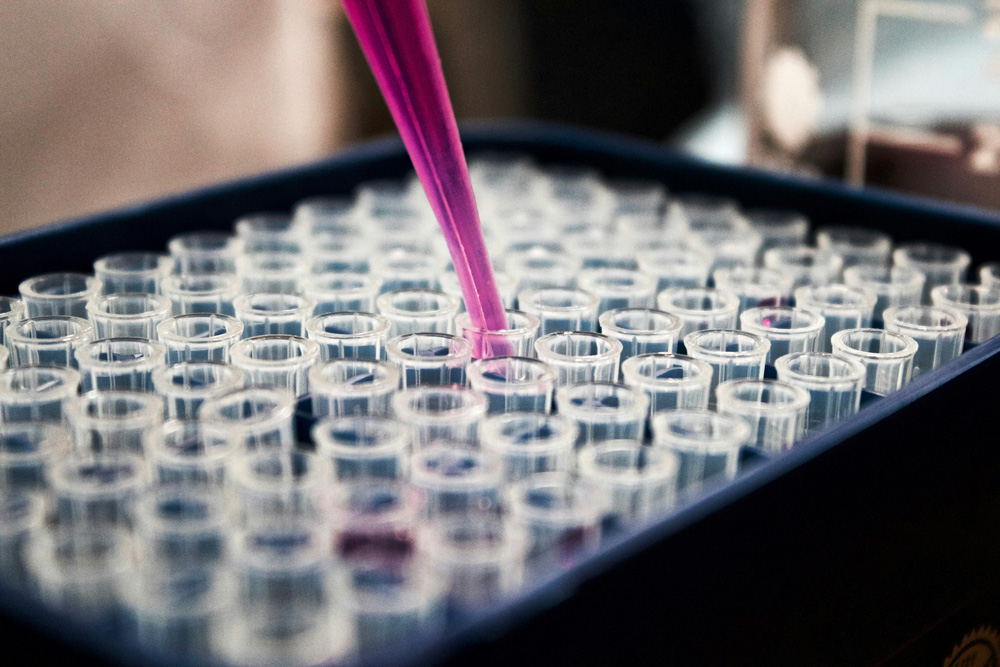 arthritis-australia-national-research-program