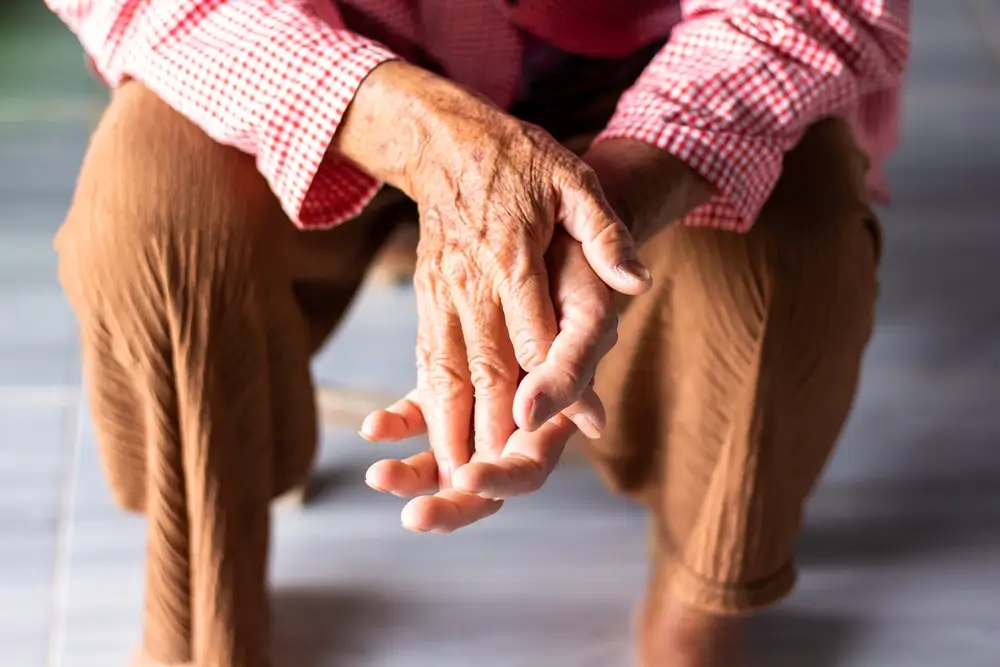 psoriatic-arthritis-australia